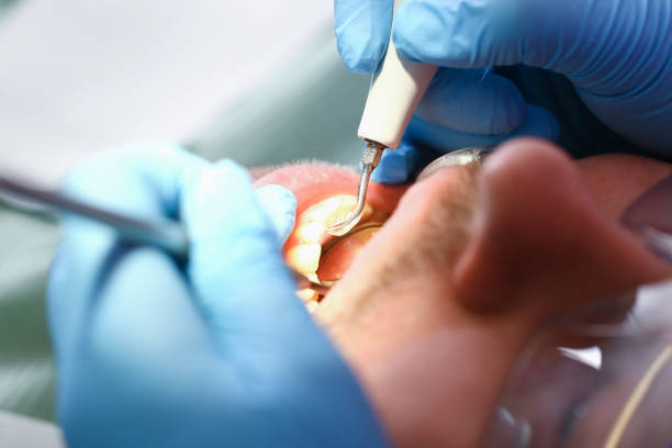 Best Emergency Treatment for Toothache in Live Oak, FL